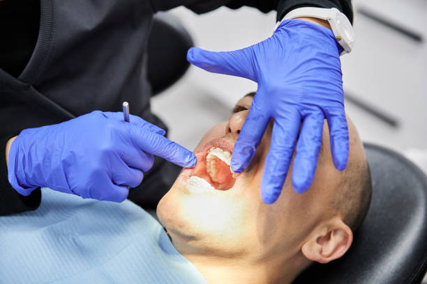 Best Broken or Chipped Tooth Repair in Clarks Summit, PA